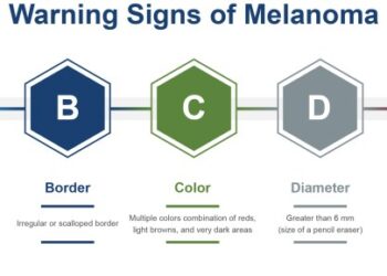 How to have more fun in the sun: UV Safety Awareness Month