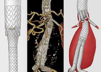 Innovative technology enables surgeons to save lives